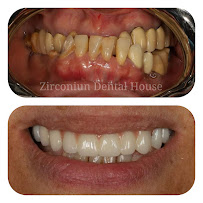 Zirconium Dental House