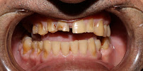 Zirconium Dental House
