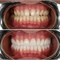 Zirconium Dental House