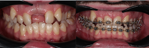 ORTHODONTIST KETEVAN BALADZE