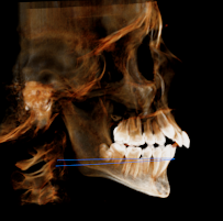 ORTHODONTIST KETEVAN BALADZE