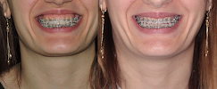 ORTHODONTIST KETEVAN BALADZE