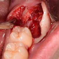 The Dental Station - Hublife Jakarta | Spesialis Gigi Bungsu, Veneer gigi, Implant Gigi & Kawat Gigi Ortho