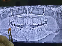 The Dental Station - Hublife Jakarta | Spesialis Gigi Bungsu, Veneer gigi, Implant Gigi & Kawat Gigi Ortho