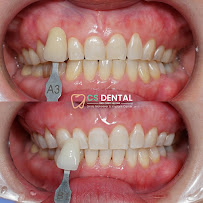 Klinik Gigi Jakarta - CS Dental Aesthetic Clinic & Dental Lab
