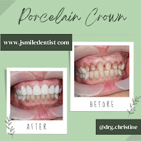 JSMILE Dental I Perawatan Saraf Gigi, Gigi Bungsu, Dental Implant & Orthodontic
