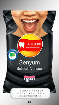 JSMILE Dental I Perawatan Saraf Gigi, Gigi Bungsu, Dental Implant & Orthodontic