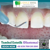 JSMILE Dental I Perawatan Saraf Gigi, Gigi Bungsu, Dental Implant & Orthodontic