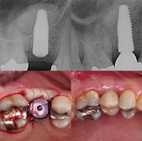 JSMILE Dental I Perawatan Saraf Gigi, Gigi Bungsu, Dental Implant & Orthodontic