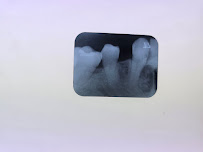 JSMILE Dental I Perawatan Saraf Gigi, Gigi Bungsu, Dental Implant & Orthodontic