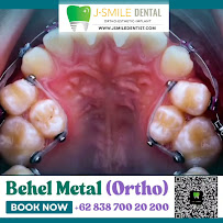 JSMILE Dental I Perawatan Saraf Gigi, Gigi Bungsu, Dental Implant & Orthodontic