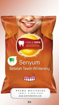 JSMILE Dental I Perawatan Saraf Gigi, Gigi Bungsu, Dental Implant & Orthodontic
