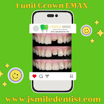 JSMILE Dental I Perawatan Saraf Gigi, Gigi Bungsu, Dental Implant & Orthodontic