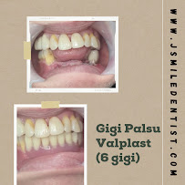 JSMILE Dental I Perawatan Saraf Gigi, Gigi Bungsu, Dental Implant & Orthodontic