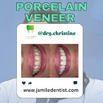 JSMILE Dental I Perawatan Saraf Gigi, Gigi Bungsu, Dental Implant & Orthodontic