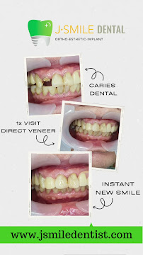 JSMILE Dental I Perawatan Saraf Gigi, Gigi Bungsu, Dental Implant & Orthodontic