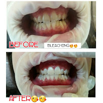 With Smile Dental Clinic