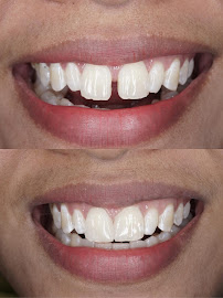 Klinik Gigi Get Dentist Gandaria | Dokter Gigi Jakarta Selatan