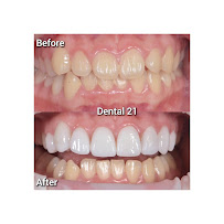 Dental 21 PIK | Klinik Premium Spesialis Memperbaiki Gigi Rusak