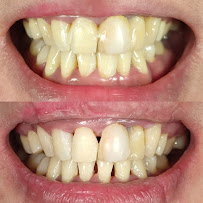 Dokter Gigi Jakarta Pusat - EDental