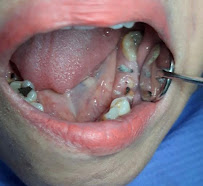 Dokter Gigi Jakarta Pusat - EDental