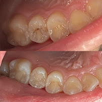 Dokter Gigi Jakarta Pusat - EDental