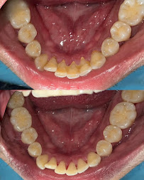 Dokter Gigi Jakarta Pusat - EDental