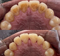 Dokter Gigi Jakarta Pusat - EDental