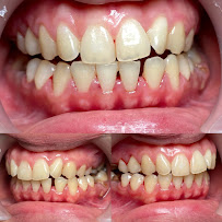 Dokter Gigi Jakarta Pusat - EDental