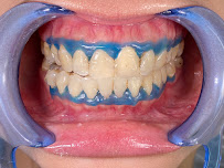 Dokter Gigi Jakarta Pusat - EDental