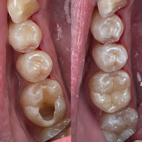 Dokter Gigi Jakarta Pusat - EDental