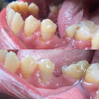 Dokter Gigi Jakarta Pusat - EDental