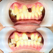 Dokter Gigi Jakarta Pusat - EDental
