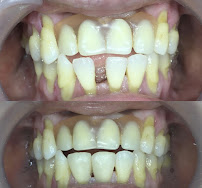 Dokter Gigi Jakarta Pusat - EDental