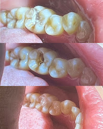 Dokter Gigi Jakarta Pusat - EDental