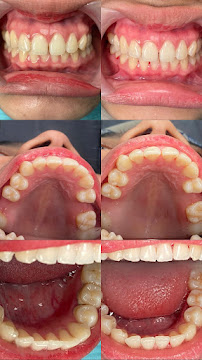 Dokter Gigi Jakarta Pusat - EDental