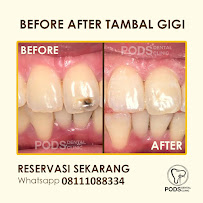 PODS Dental Clinic - Tebet