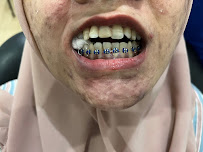 Dokter Gigi Jakarta Barat - EDental