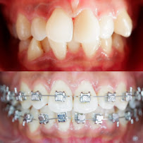 Dokter Gigi Jakarta Barat - EDental