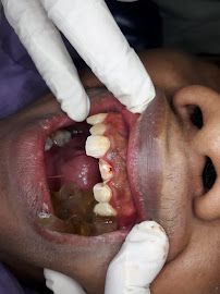 Dokter Gigi Jakarta Barat - EDental