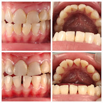 Dokter Gigi Jakarta Barat - EDental