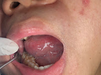 Dokter Gigi Jakarta Barat - EDental