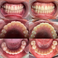 Dokter Gigi Jakarta Barat - EDental