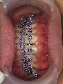 Dokter Gigi Jakarta Barat - EDental