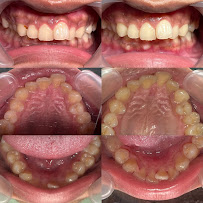 Dokter Gigi Jakarta Barat - EDental
