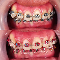 Dokter Gigi Jakarta Barat - EDental