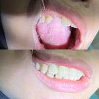 Dokter Gigi Jakarta Barat - EDental