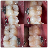 Dokter Gigi Jakarta Barat - EDental