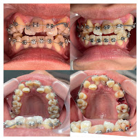 Dokter Gigi Jakarta Barat - EDental