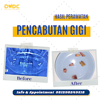 Dentalmate Dental Care | Dokter Gigi Jakarta Timur